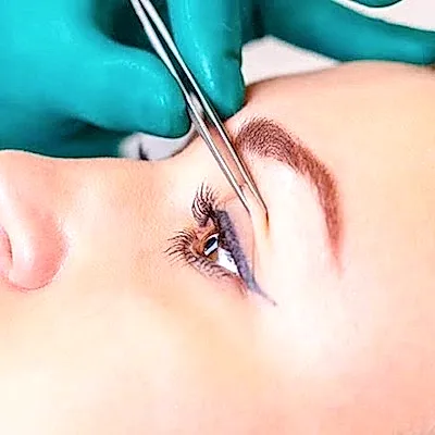 GÖZ KAPAĞI ESTETİĞİ 